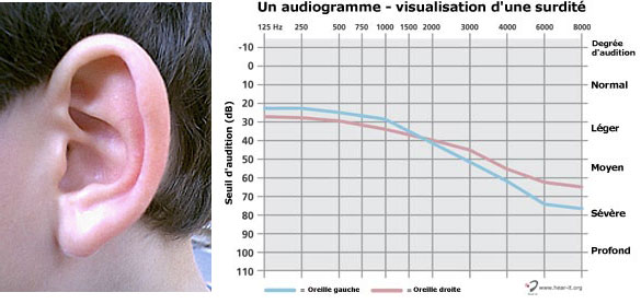 EarBay - Votre capital audition